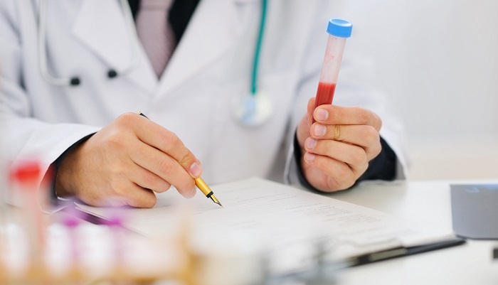 تفسیر نتایج آزمایش‌های پاراکلینیکی در معاینات شغلی طب کار آریا پژوهان