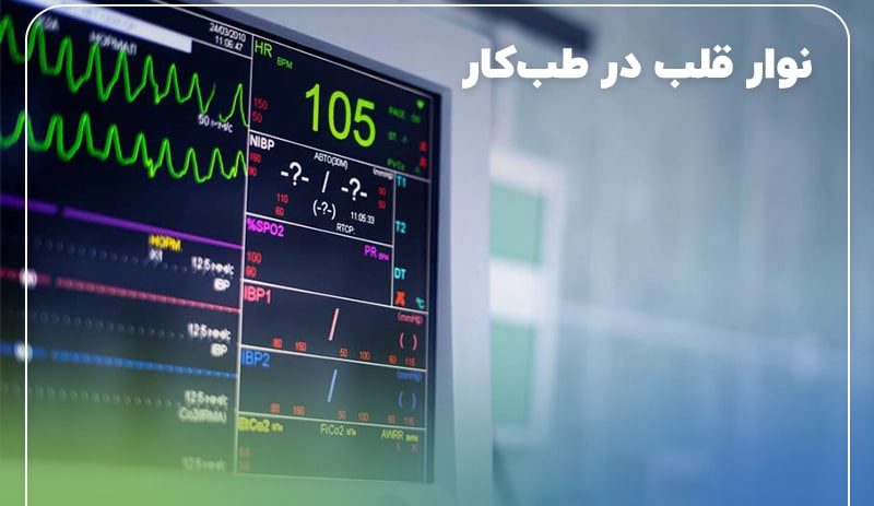 نوار قلب (ECG) در معاینات طب کار آریا پژوهان غرب