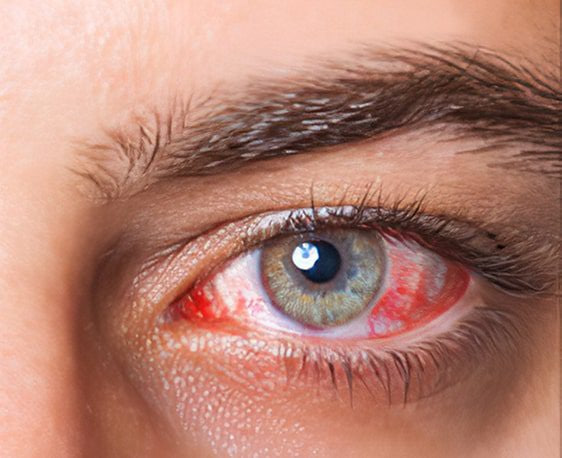 تأثیر سلامت بینایی بر بهره‌وری شغلی در مرکز تخصصی طب کار